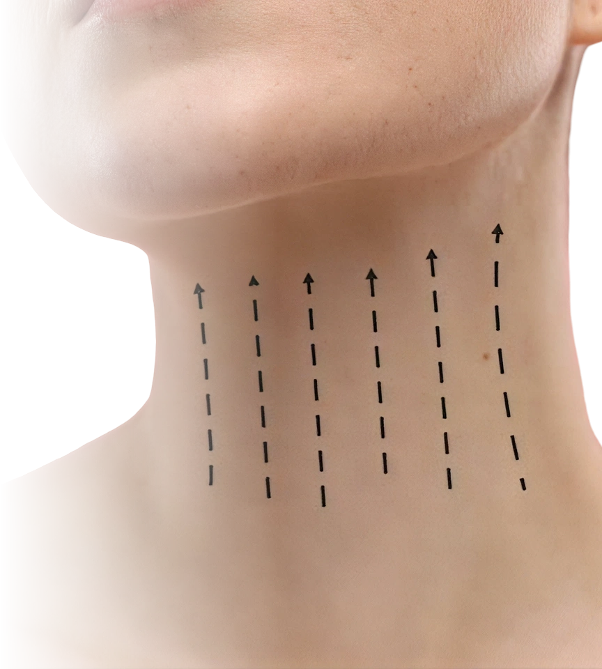Cuello femenino con marcas de vectores de elevación