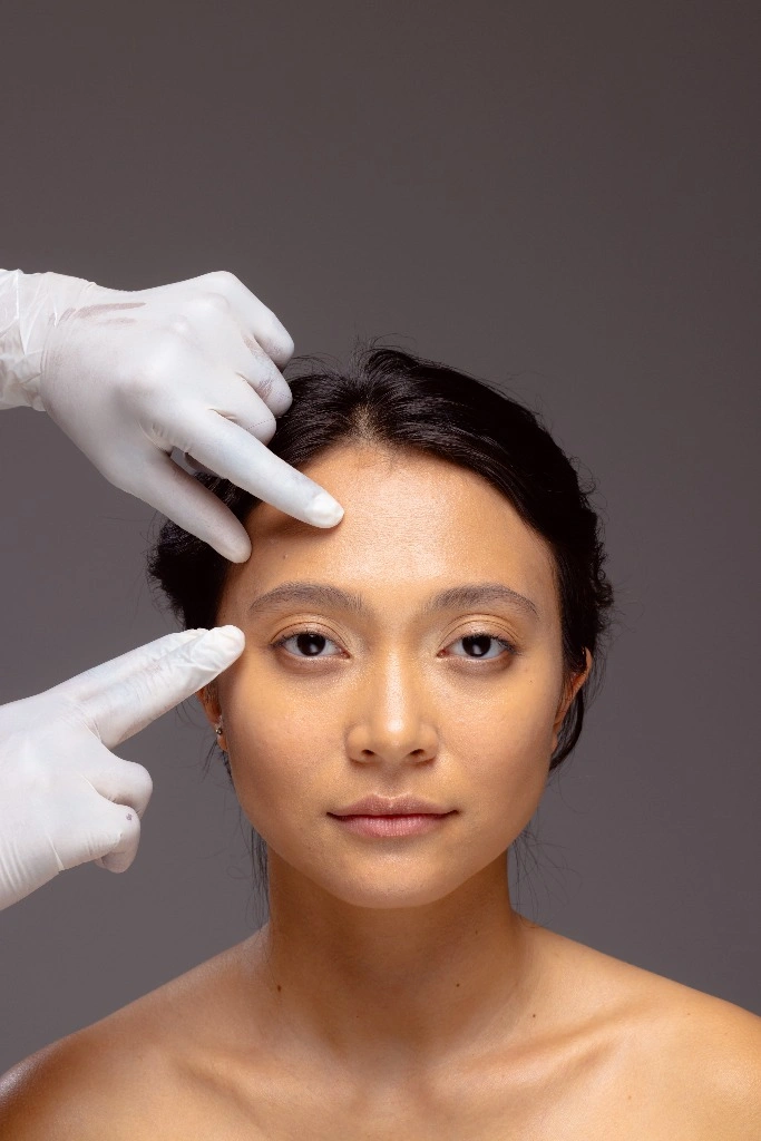 Foreheadplasty