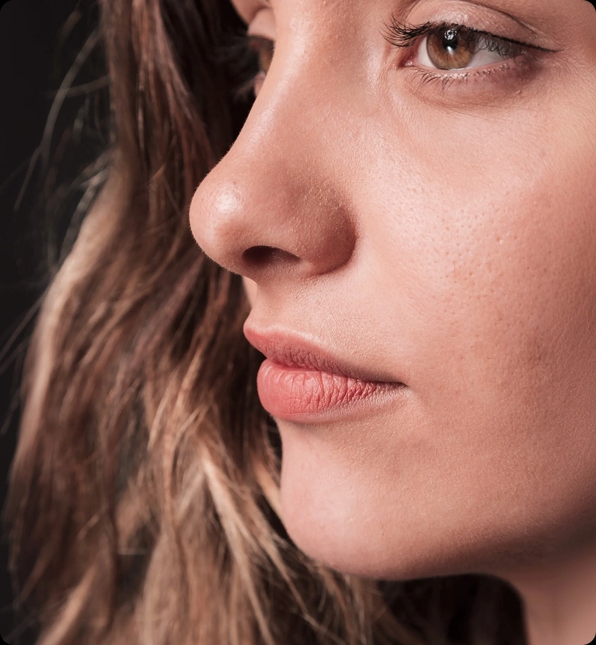 Woman’s face in profile highlighting the nose after rhinoplasty